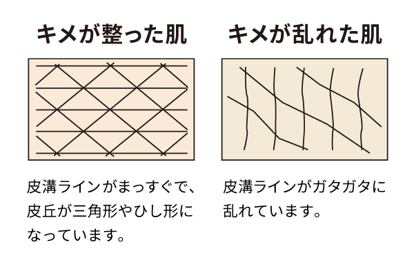 キメが整った肌と乱れた肌